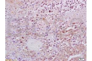 Formalin-fixed and paraffin embedded mouse lymphoma tissue labeled with Anti-Dnmt1 Polyclonal Antibody, Unconjugated (ABIN671796) at 1:200, followed by conjugation to the secondary antibody and DAB staining (DNMT1 antibody  (AA 21-120))