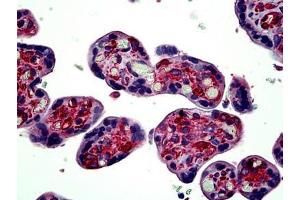 Human Placenta: Formalin-Fixed, Paraffin-Embedded (FFPE) (TUBA4A antibody  (AA 426-450))