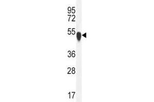 TUBA1C antibody western blot analysis in K562 lysate (TUBA1C antibody  (AA 414-441))