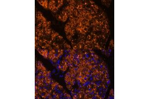 Immunofluorescence (IF) image for anti-serpin Peptidase Inhibitor, Clade I (Pancpin), Member 2 (SERPINI2) (AA 56-405) antibody (ABIN6147617)