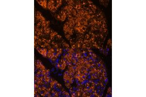 Immunofluorescence analysis of rat pancreas using SERPINI2 Polyclonal Antibody (ABIN6131321, ABIN6147617, ABIN6147618 and ABIN6215429) at dilution of 1:100 (40x lens). (SERPINI2 antibody  (AA 56-405))