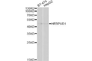 Western blot analysis of extracts of various cell lines, using HERPUD1 antibody. (HERPUD1 antibody)