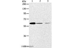 Western blot analysis of NIH/3T3 and SKOV3 cell, human ovarian cancer tissue, using ABCE1 Polyclonal Antibody at dilution of 1:450