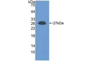 Detection of Recombinant PRL, Human using Polyclonal Antibody to Prolactin (PRL) (Prolactin antibody  (AA 29-227))