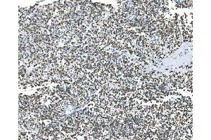 IHC analysis of Glycine decarboxylase/GLDC using anti-Glycine decarboxylase/GLDC antibody (ABIN7602073). (GLDC antibody  (AA 574-1020))