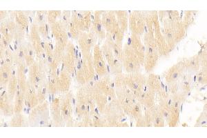 Detection of MX1 in Human Cardiac Muscle Tissue using Monoclonal Antibody to Myxovirus Resistance 1 (MX1) (MX1 antibody  (AA 80-342))