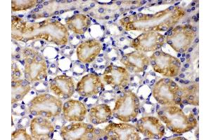 TCP1 theta was detected in paraffin-embedded sections of mouse kidney tissues using rabbit anti- TCP1 theta Antigen Affinity purified polyclonal antibody (Catalog # ) at 1 µg/mL. (CCT8 antibody  (AA 421-548))
