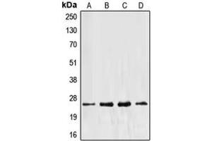 Western blot analysis of EEF1B2 expression in Jurkat (A), HeLa (B), MCF7 (C), A431 (D) whole cell lysates.