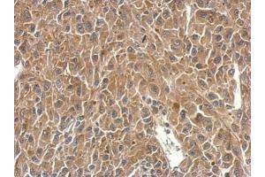IHC-P Image SH3BP1 antibody detects SH3BP1 protein at cytosol on U87 xenograft by immunohistochemical analysis. (SH3BP1 antibody  (C-Term))