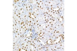 Immunohistochemistry of paraffin-embedded rat kidney using Phospho-RB-S795 Rabbit pAb (ABIN3023606, ABIN3023607, ABIN3023608 and ABIN6225464) at dilution of 1:50 (40x lens). (Retinoblastoma 1 antibody  (pSer795))