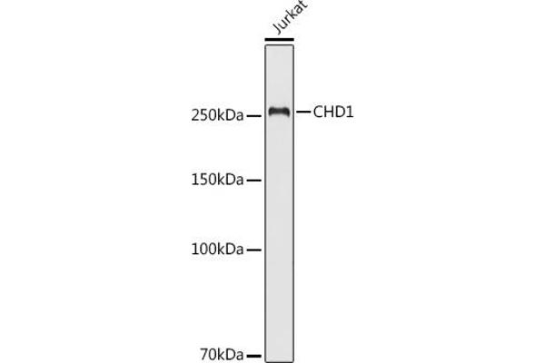 CHD1 Antikörper  (C-Term)
