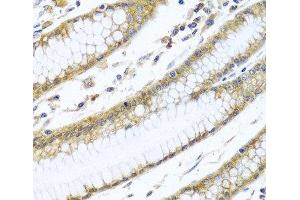 Immunohistochemistry of paraffin-embedded Human stomach using GNAI3 Polyclonal Antibody at dilution of 1:100 (40x lens). (GNAI3 antibody)