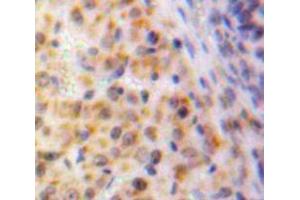 IHC-P analysis of Ovary tissue, with DAB staining.