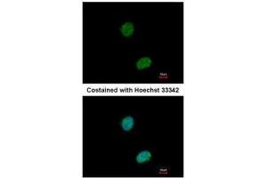 ICC/IF Image Immunofluorescence analysis of paraformaldehyde-fixed HeLa, using Ataxin 3, antibody at 1:500 dilution. (Ataxin 3 antibody)