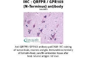 Image no. 1 for anti-Pyroglutamylated RFamide Peptide Receptor (QRFPR) (N-Term) antibody (ABIN1738667) (QRFPR antibody  (N-Term))