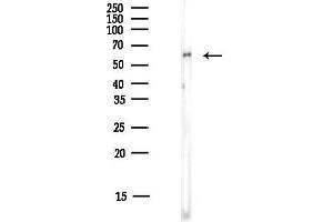 anti-Serotonin Receptor 2B (HTR2B) (Internal Region) antibody