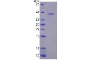 SDS-PAGE analysis of Human NAT8L Protein.