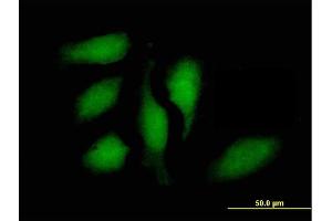 Immunofluorescence of purified MaxPab antibody to STAT1 on HeLa cell.