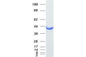 Western Blotting (WB) image for serpin Peptidase Inhibitor, Clade B (Ovalbumin), Member 5 (SERPINB5) protein (Myc-DYKDDDDK Tag) (ABIN2731812)