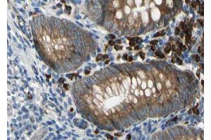 ABIN6267024 at 1/100 staining human Appendix tissue sections by IHC-P. (SDC4 antibody  (C-Term))
