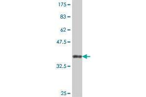 Western Blot detection against Immunogen (37.
