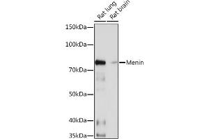 Western blot analysis of extracts of various cell lines, using Menin Rabbit mAb (ABIN7268697) at 1:1000 dilution. (Menin antibody)