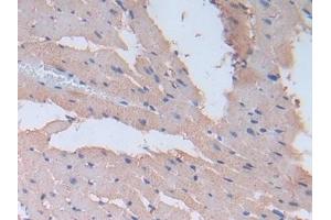 Immunohistochemistry (IHC) image for anti-Fibronectin (AA 355-558) antibody (ABIN7429001)