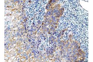 IHC analysis of Poliovirus Receptor/PVR using anti-Poliovirus Receptor/PVR antibody (ABIN7601072).