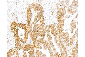 Immunohistochemistry (IHC) image for anti-Transmembrane Protein 173 (TMEM173) (C-Term) antibody (ABIN7795818) (Recombinant STING/TMEM173 antibody  (C-Term))
