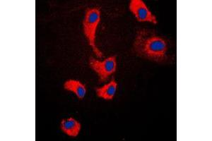 Immunofluorescent analysis of MYD88 staining in Jurkat cells. (MYD88 antibody  (Center))
