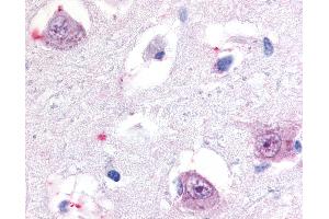 Anti-ROR Beta antibody IHC of human brain, thalamus. (RORB antibody  (Hinge Region))