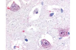 Anti-ROR Beta antibody IHC of human brain, thalamus. (RORB antibody  (Hinge Region))