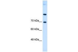 Image no. 1 for anti-Solute Carrier Family 7 (Cationic Amino Acid Transporter, Y+ System), Member 4 (SLC7A4) (AA 281-330) antibody (ABIN6736656)
