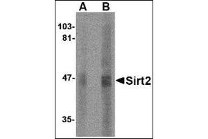 Western blot analysis of SIRT2 in human brain lysate with this product at (A) 2.