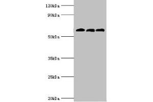 Western blot All lanes: 4-aminobutyrate aminotransferase, mitochondrial antibody at 10 μg/mL Lane 1: Rat liver tissue Lane 2: Mouse pancreatic tissue Lane 3: Mouse kidney tissue Secondary Goat polyclonal to rabbit IgG at 1/10000 dilution Predicted band size: 56 kDa Observed band size: 56 kDa (ABAT antibody  (AA 29-300))