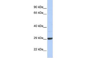 C10ORF56 antibody used at 1 ug/ml to detect target protein. (ZCCHC24 antibody  (Middle Region))