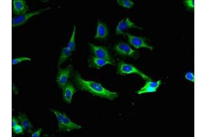 Immunofluorescent analysis of Hela cells using ABIN7146334 at dilution of 1:100 and Alexa Fluor 488-congugated AffiniPure Goat Anti-Rabbit IgG(H+L) (KCNMA1 antibody  (AA 1-86))