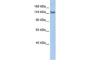 WB Suggested Anti-TCERG1 Antibody Titration:  0. (TCERG1 antibody  (N-Term))