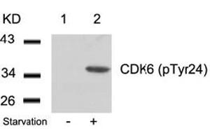 Image no. 2 for anti-Cyclin-Dependent Kinase 6 (CDK6) (pTyr24) antibody (ABIN319290) (CDK6 antibody  (pTyr24))