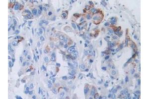 Used in DAB staining on fromalin fixed paraffin- embedded kidney tissue (SLC12A3 antibody  (AA 3-146))