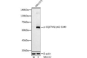Western blot analysis of extracts of NIH/3T3 cells, using Phospho-SQSTM1/p62-S349 antibody (ABIN7270206) at 1:500 dilution. (SQSTM1 antibody  (pSer349))
