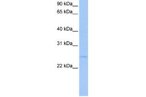 WB Suggested Anti-CTA-126B4. (CTA-126B4.3 (N-Term) antibody)
