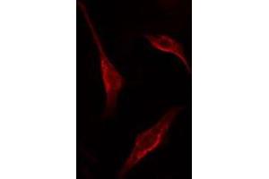 ABIN6275361 staining HT29 cells by IF/ICC. (PNN antibody  (Internal Region))
