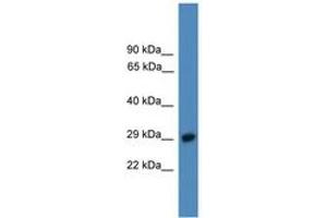 Image no. 1 for anti-Proteasome (Prosome, Macropain) 26S Subunit, Non-ATPase, 9 (PSMD9) (C-Term) antibody (ABIN6745293) (PSMD9 antibody  (C-Term))