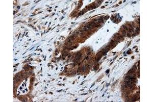 Image no. 2 for anti-Mitochondrial Translational Release Factor 1-Like (MTRF1L) antibody (ABIN1498693)