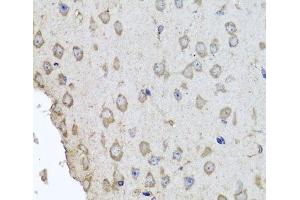 HBa2 antibody