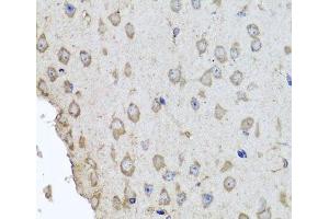 Immunohistochemistry of paraffin-embedded Mouse brain using HBA2 Polyclonal Antibody at dilution of 1:100 (40x lens). (HBa2 antibody)
