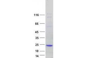 Transmembrane Protein 80 (TMEM80) (Transcript Variant 2) protein (Myc-DYKDDDDK Tag)