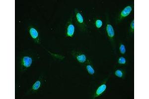 IF analysis of Emerin using anti-Emerin antibody (ABIN4886569). (Emerin antibody  (N-Term))