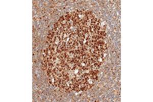 Immunohistochemical analysis of paraffin-embedded human tonsil tissue using (ABIN1882267 and ABIN2838476) performed on the Leica® BOND RXm. (MSH2 antibody)